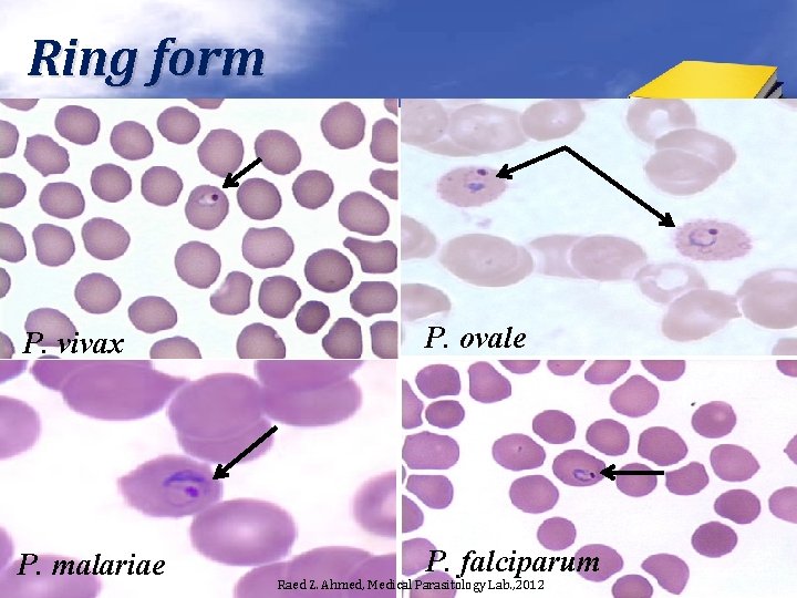 Ring form P. vivax P. ovale P. malariae P. falciparum Raed Z. Ahmed, Medical