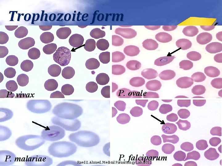 Trophozoite form P. vivax P. malariae P. ovale P. falciparum Raed Z. Ahmed, Medical