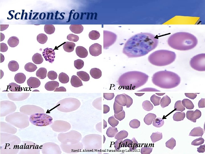 Schizonts form P. vivax P. ovale P. malariae P. falciparum Raed Z. Ahmed, Medical