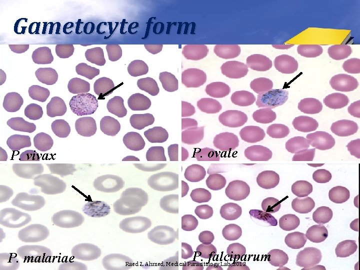 Gametocyte form P. vivax P. malariae P. ovale P. falciparum Raed Z. Ahmed, Medical