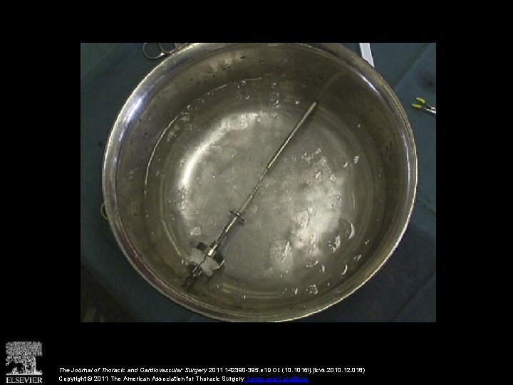 The Journal of Thoracic and Cardiovascular Surgery 2011 142390 -395. e 1 DOI: (10.