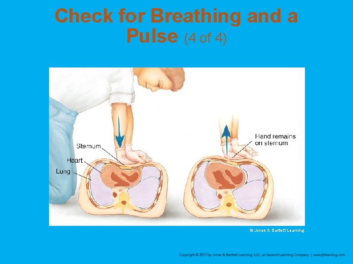 Check for Breathing and a Pulse (4 of 4) © Jones & Bartlett Learning.