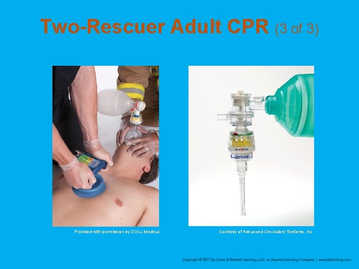 Two-Rescuer Adult CPR (3 of 3) Provided with permission by ZOLL Medical. Courtesy of