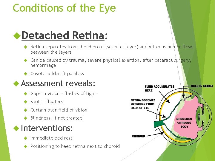 Conditions of the Eye Detached Retina: Retina separates from the choroid (vascular layer) and