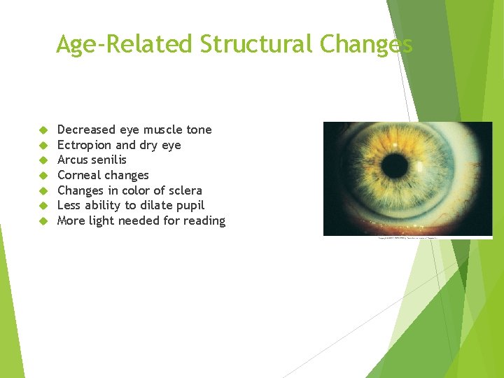 Age-Related Structural Changes Decreased eye muscle tone Ectropion and dry eye Arcus senilis Corneal