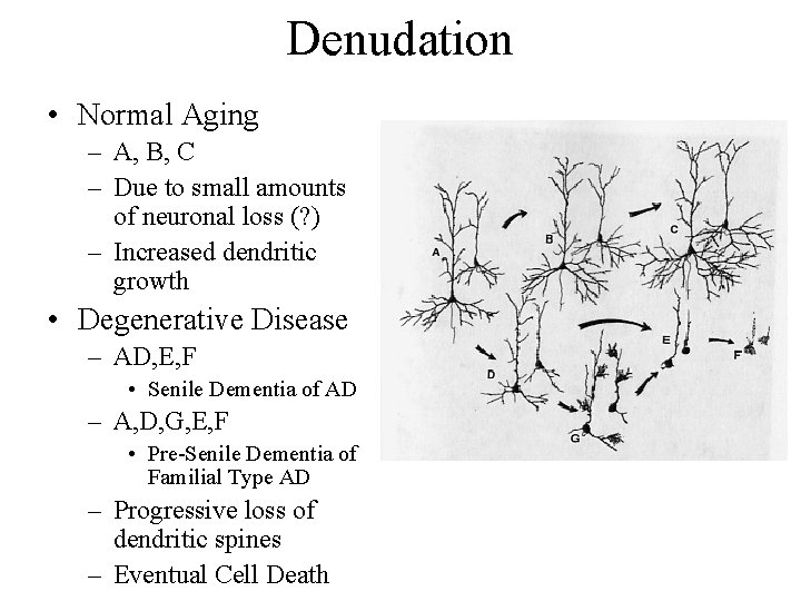 Denudation • Normal Aging – A, B, C – Due to small amounts of