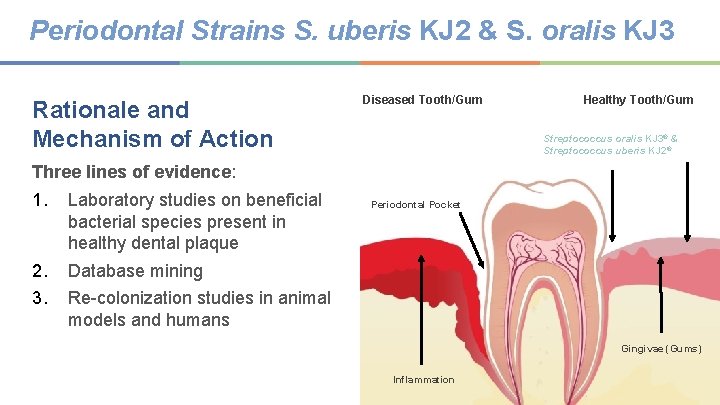 Periodontal Strains S. uberis KJ 2 & S. oralis KJ 3 Rationale and Mechanism