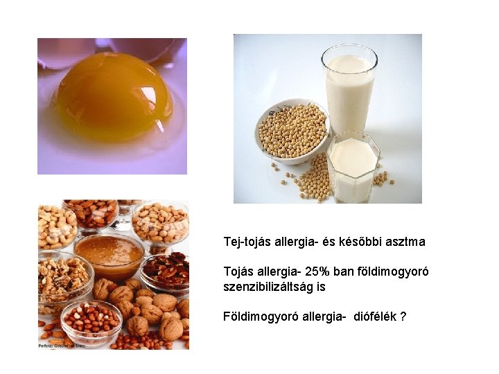 Tej-tojás allergia- és későbbi asztma Tojás allergia- 25% ban földimogyoró szenzibilizáltság is Földimogyoró allergia-
