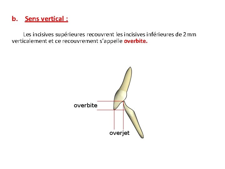 b. Sens vertical : Les incisives supérieures recouvrent les incisives inférieures de 2 mm