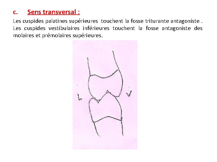 c. Sens transversal : Les cuspides palatines supérieures touchent la fosse triturante antagoniste. Les