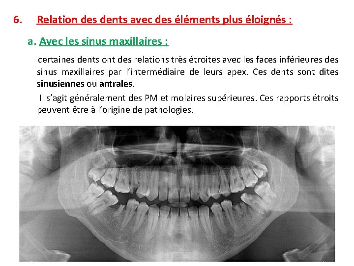 6. Relation des dents avec des éléments plus éloignés : a. Avec les sinus