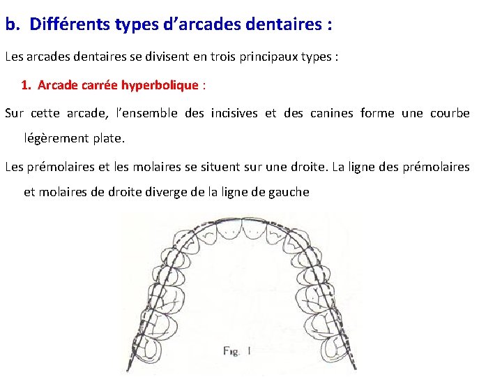 b. Différents types d’arcades dentaires : Les arcades dentaires se divisent en trois principaux