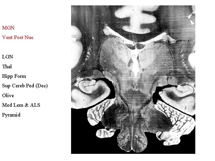 MGN Vent Post Nuc LGN Thal Hipp Form Sup Cereb Ped (Dec) Olive Med