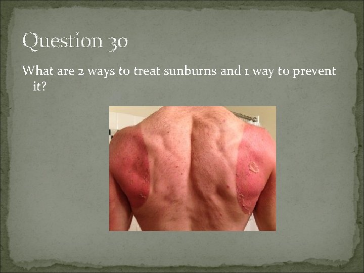 Question 30 What are 2 ways to treat sunburns and 1 way to prevent