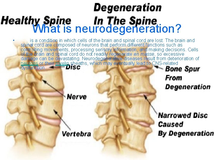 What is neurodegeneration? • is a condition in which cells of the brain and