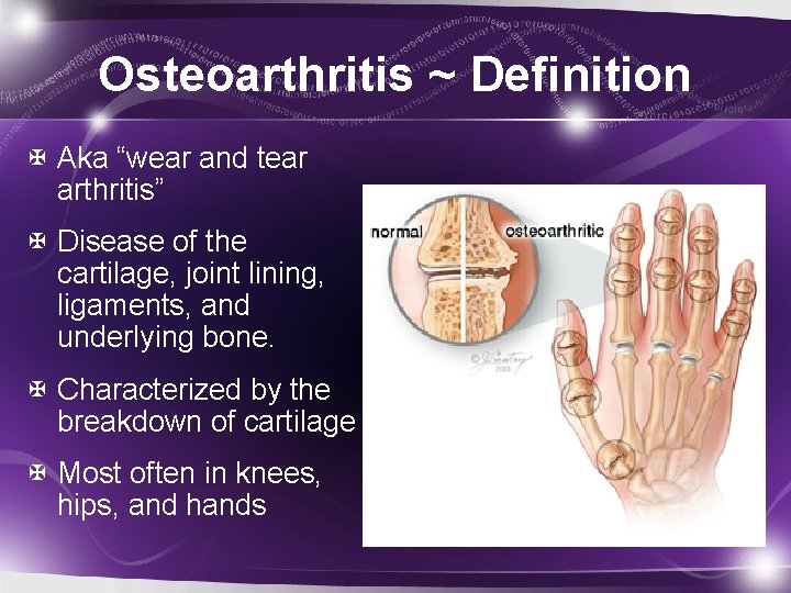 Osteoarthritis ~ Definition Aka “wear and tear arthritis” Disease of the cartilage, joint lining,