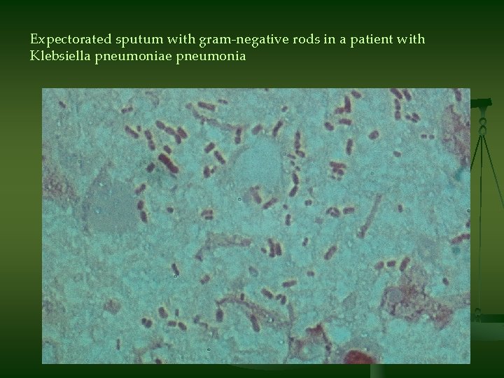 Expectorated sputum with gram-negative rods in a patient with Klebsiella pneumoniae pneumonia 