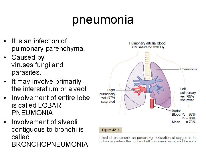 pneumonia • It is an infection of pulmonary parenchyma. • Caused by viruses, fungi,