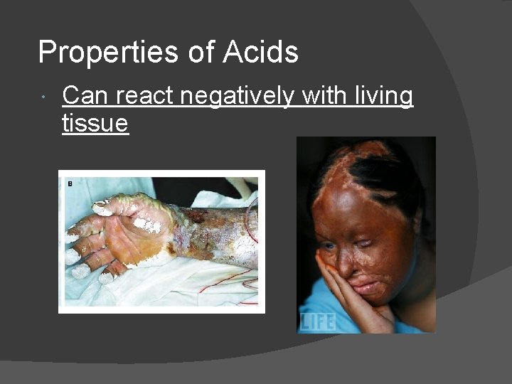 Properties of Acids Can react negatively with living tissue 
