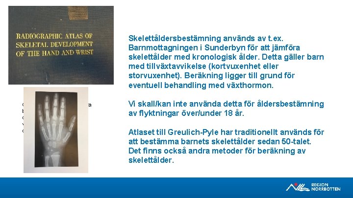 Skelettåldersbestämning används av t. ex. Barnmottagningen i Sunderbyn för att jämföra skelettålder med kronologisk