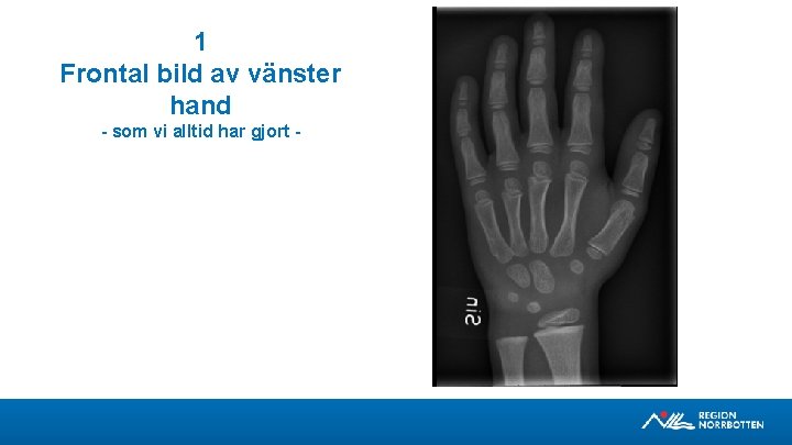 1 Frontal bild av vänster hand - som vi alltid har gjort - 