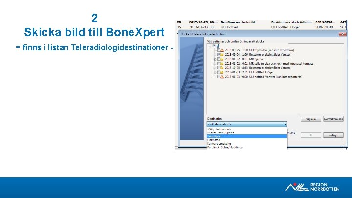 2 Skicka bild till Bone. Xpert - finns i listan Teleradiologidestinationer - 