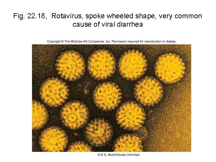 Fig. 22. 18, Rotavirus, spoke wheeled shape, very common cause of viral diarrhea 