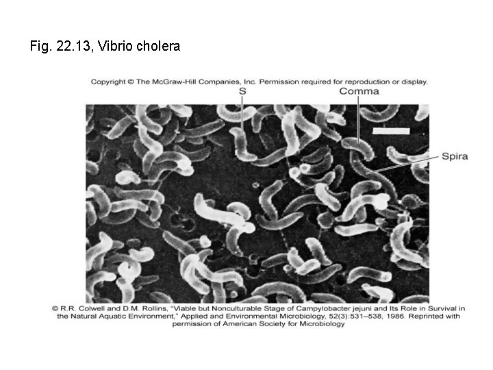 Fig. 22. 13, Vibrio cholera 