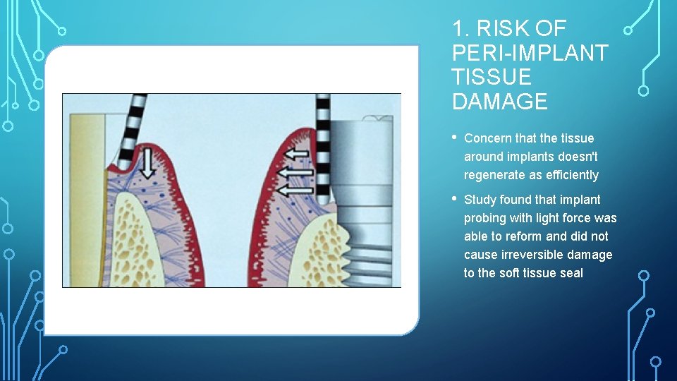 1. RISK OF PERI-IMPLANT TISSUE DAMAGE • Concern that the tissue around implants doesn't