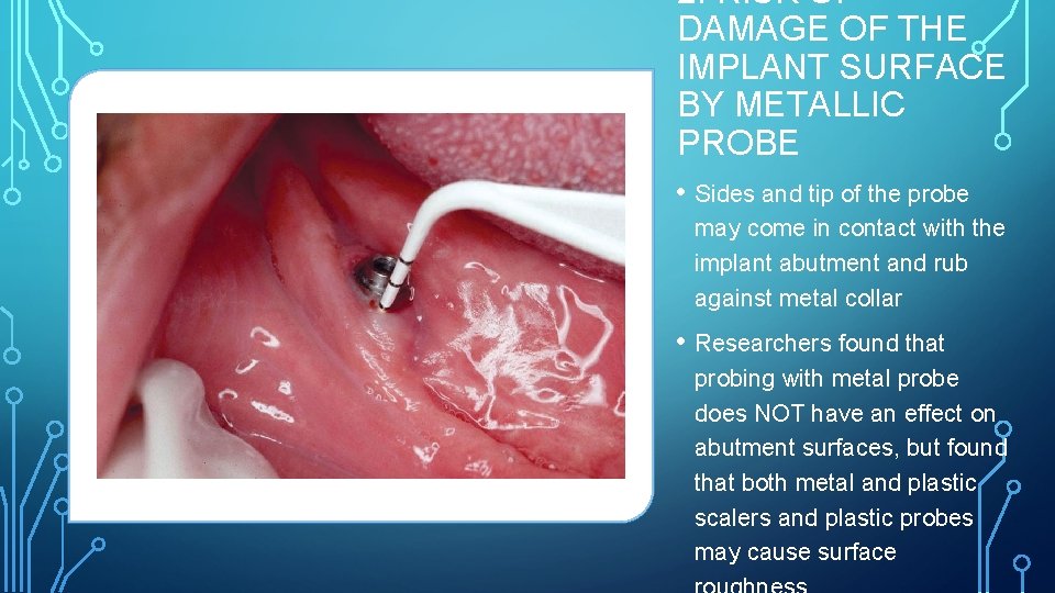 2. RISK OF DAMAGE OF THE IMPLANT SURFACE BY METALLIC PROBE • Sides and