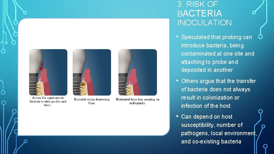 3. RISK OF BACTERIA INOCULATION • Speculated that probing can introduce bacteria, being contaminated