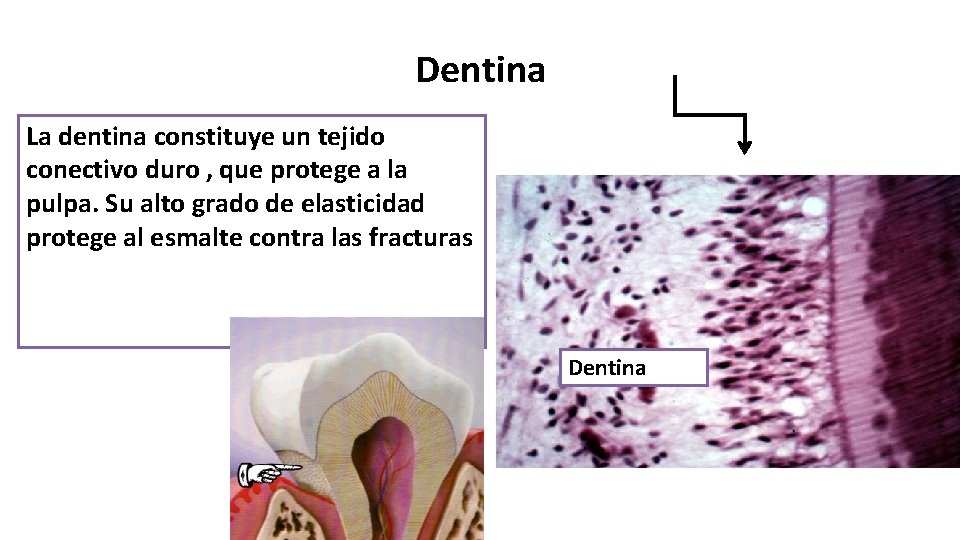Dentina La dentina constituye un tejido conectivo duro , que protege a la pulpa.