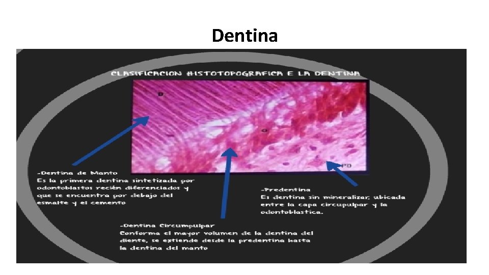 Dentina 