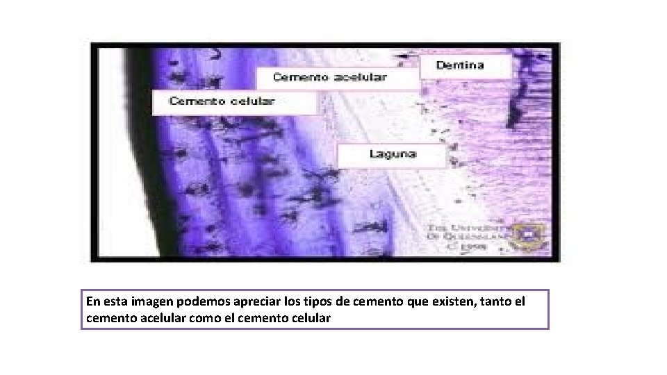 En esta imagen podemos apreciar los tipos de cemento que existen, tanto el cemento