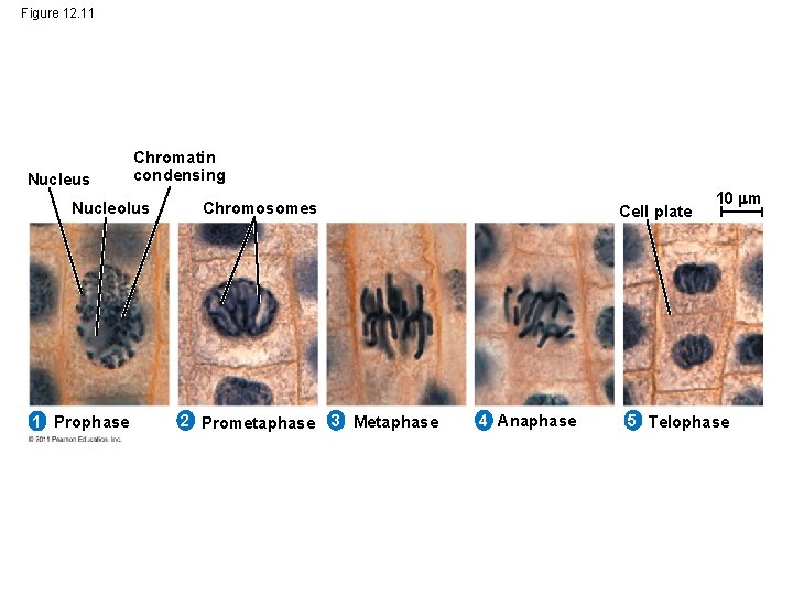 Figure 12. 11 Nucleus Chromatin condensing Nucleolus 1 Prophase Chromosomes 2 Prometaphase 3 Metaphase