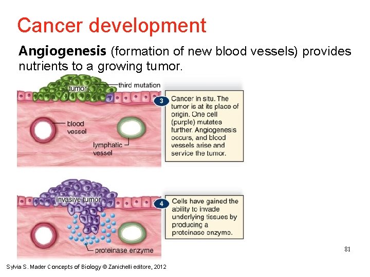 Cancer development Angiogenesis (formation of new blood vessels) provides nutrients to a growing tumor.