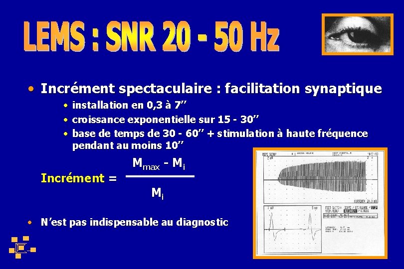  • Incrément spectaculaire : facilitation synaptique • • • installation en 0, 3