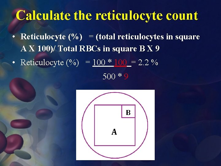 Calculate the reticulocyte count • Reticulocyte (%) = (total reticulocytes in square A X