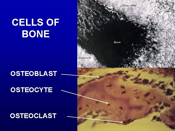 CELLS OF BONE OSTEOBLAST OSTEOCYTE OSTEOCLAST 