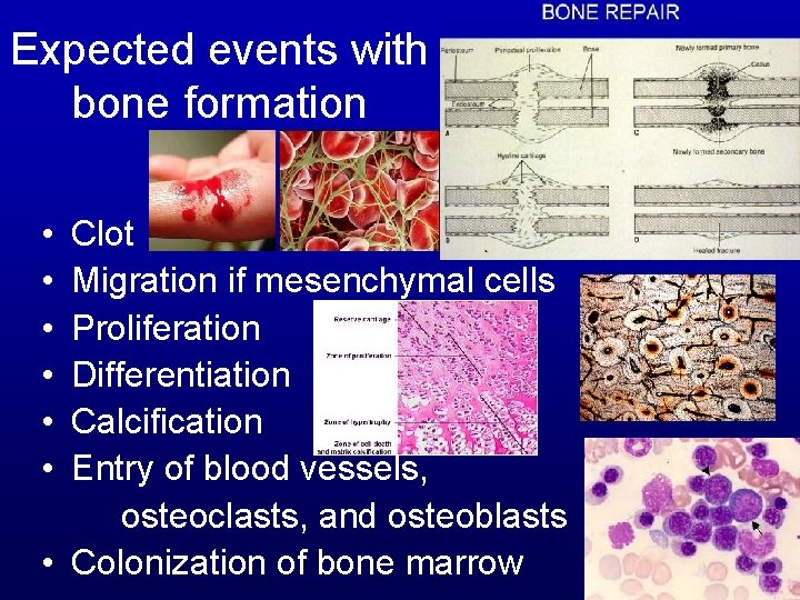 Expected events with bone formation • • • Clot Migration if mesenchymal cells Proliferation