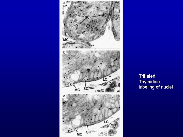 Tritiated Thymidine labeling of nuclei 