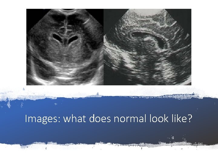 Images: what does normal look like? 