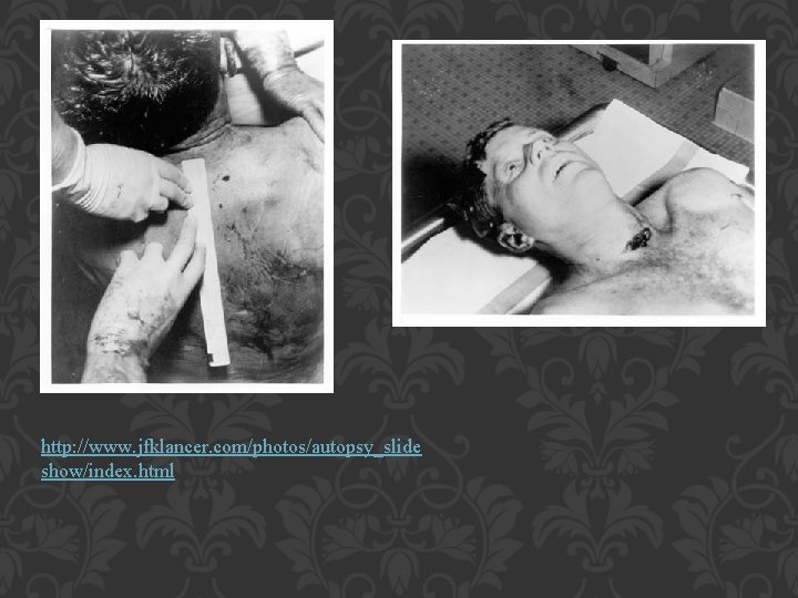 http: //www. jfklancer. com/photos/autopsy_slide show/index. html 