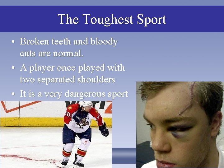 The Toughest Sport • Broken teeth and bloody cuts are normal. • A player