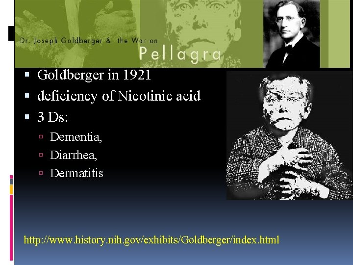  Goldberger in 1921 deficiency of Nicotinic acid 3 Ds: Dementia, Diarrhea, Dermatitis http: