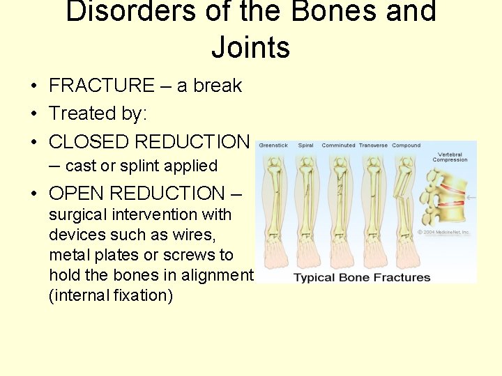 Disorders of the Bones and Joints • FRACTURE – a break • Treated by: