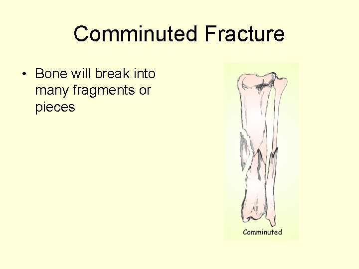 Comminuted Fracture • Bone will break into many fragments or pieces 