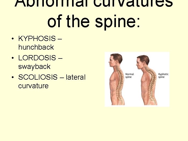 Abnormal curvatures of the spine: • KYPHOSIS – hunchback • LORDOSIS – swayback •