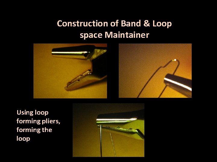 Construction of Band & Loop space Maintainer Using loop forming pliers, forming the loop