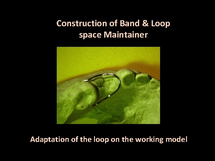 Construction of Band & Loop space Maintainer Adaptation of the loop on the working